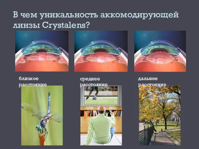 В чем уникальность аккомодирующей линзы Crystalens? близкое расстояние среднее расстояние дальнее расстояние