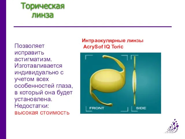 Торическая линза Позволяет исправить астигматизм. Изготавливается индивидуально с учетом всех особенностей глаза, в