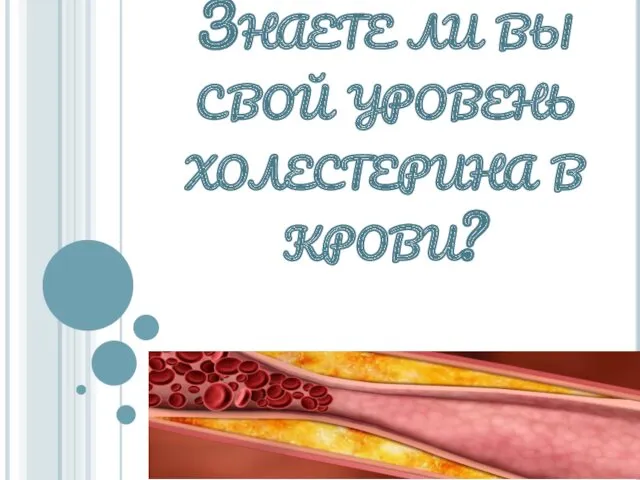 Знаете ли вы свой уровень холестерина в крови?