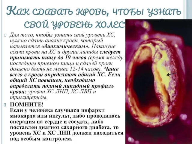 Как сдавать кровь, чтобы узнать свой уровень холестерина? Для того,