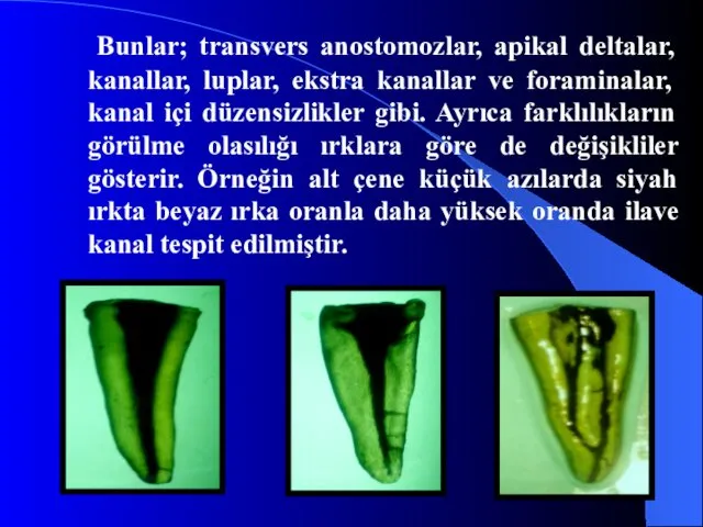 Bunlar; transvers anostomozlar, apikal deltalar, kanallar, luplar, ekstra kanallar ve