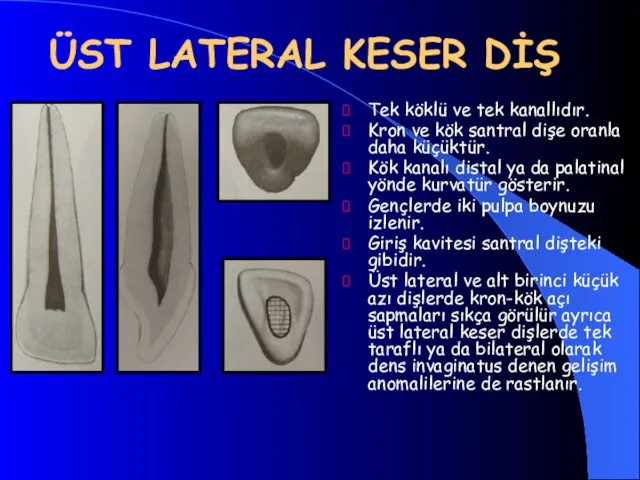 ÜST LATERAL KESER DİŞ Tek köklü ve tek kanallıdır. Kron