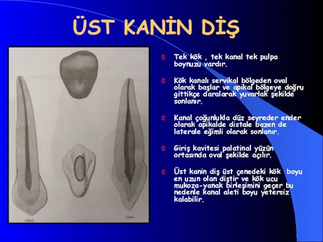 ÜST KANİN DİŞ Tek kök , tek kanal tek pulpa