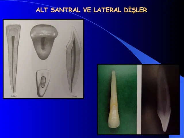 ALT SANTRAL VE LATERAL DİŞLER