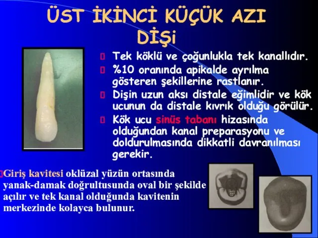 ÜST İKİNCİ KÜÇÜK AZI DİŞi Tek köklü ve çoğunlukla tek