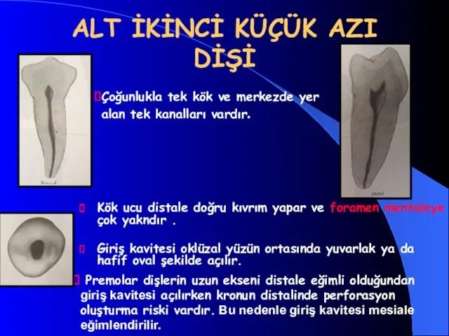 ALT İKİNCİ KÜÇÜK AZI DİŞİ Kök ucu distale doğru kıvrım