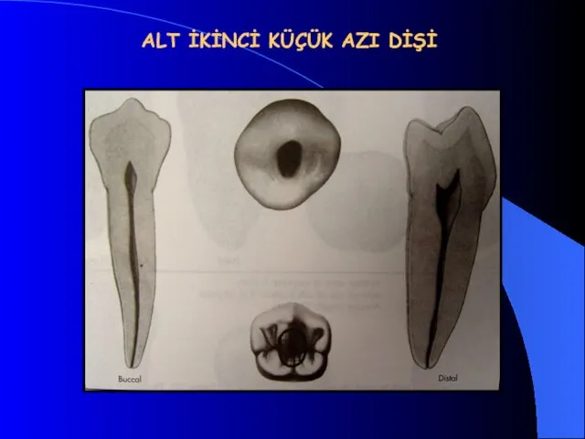 ALT İKİNCİ KÜÇÜK AZI DİŞİ