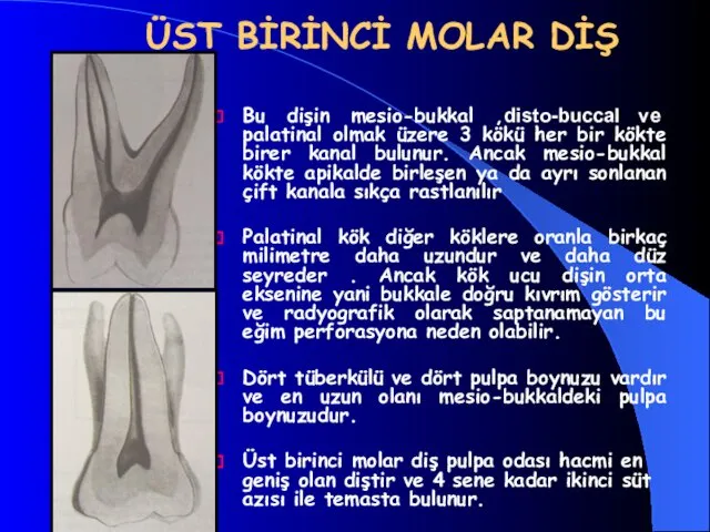 ÜST BİRİNCİ MOLAR DİŞ Bu dişin mesio-bukkal ,disto-buccal ve palatinal