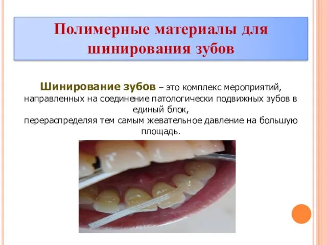Полимерные материалы для шинирования зубов Шинирование зубов – это комплекс