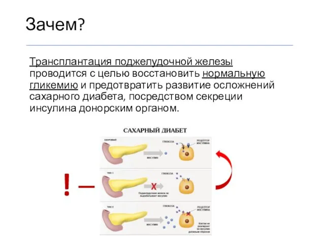 Зачем? Трансплантация поджелудочной железы проводится с целью восстановить нормальную гликемию