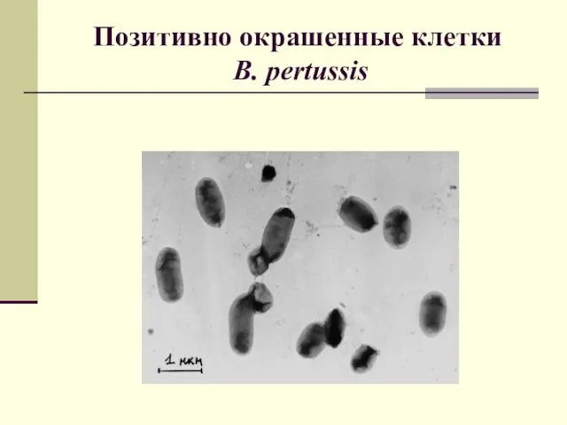 Позитивно окрашенные клетки B. pertussis