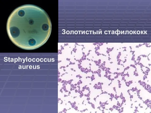 Staphylococcus aureus Золотистый стафилококк