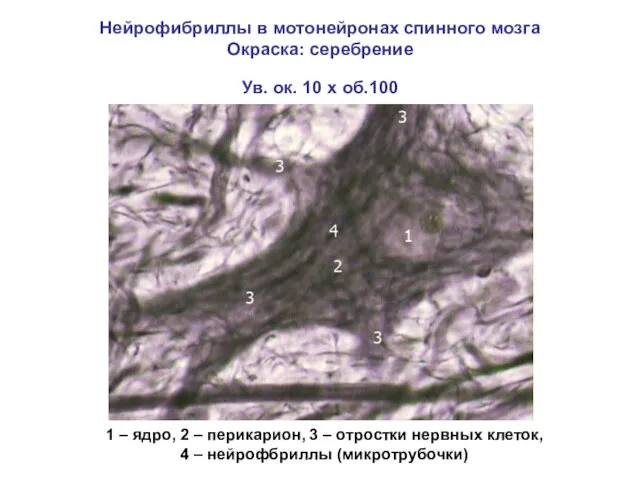 Нейрофибриллы в мотонейронах спинного мозга Окраска: серебрение Ув. ок. 10 х об.100 1