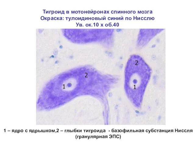 Тигроид в мотонейронах спинного мозга Окраска: тулоидиновый синий по Нисслю Ув. ок.10 х