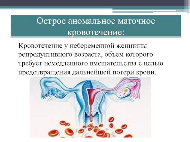 Острое аномальное маточное кровотечение: Кровотечение у небеременной женщины репродуктивного возраста,