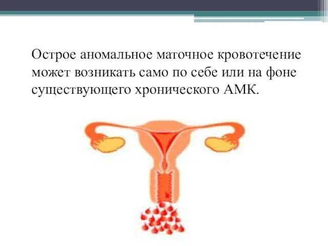 Острое аномальное маточное кровотечение может возникать само по себе или на фоне существующего хронического АМК.