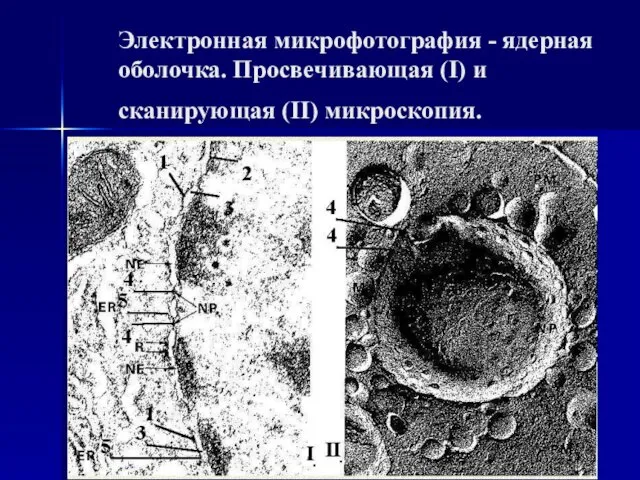 Электронная микрофотография - ядерная оболочка. Просвечивающая (I) и сканирующая (II) микроскопия.