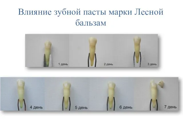 Влияние зубной пасты марки Лесной бальзам