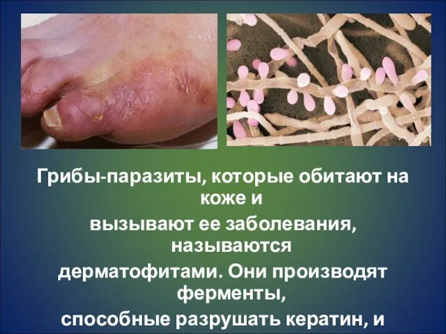 Грибы-паразиты, которые обитают на коже и вызывают ее заболевания, называются дерматофитами. Они производят