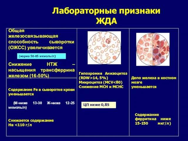 ЦП ниже 0,85 Содержание ферритина ниже 15-150 мкг/л) Лабораторные признаки ЖДА (норма 50-85 мкмоль/л)