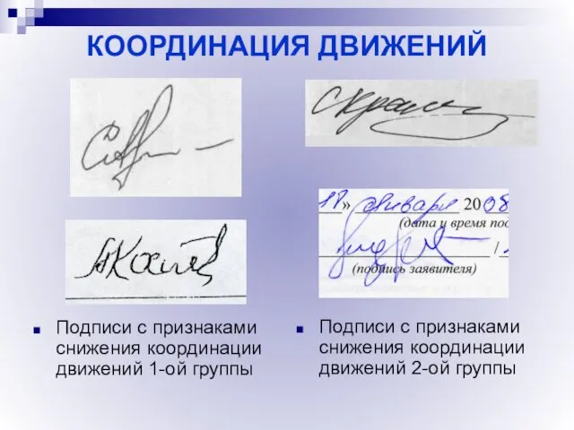 Подписи с признаками снижения координации движений 1-ой группы Подписи с признаками снижения координации