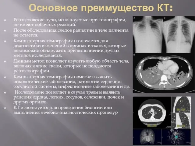 Основное преимущество КТ: Рентгеновские лучи, используемые при томографии, не имеют