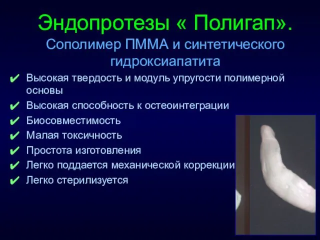 Эндопротезы « Полигап». Сополимер ПММА и синтетического гидроксиапатита Высокая твердость