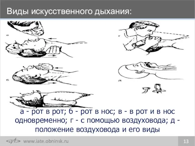 Виды искусственного дыхания: 13 а - рот в рот; б