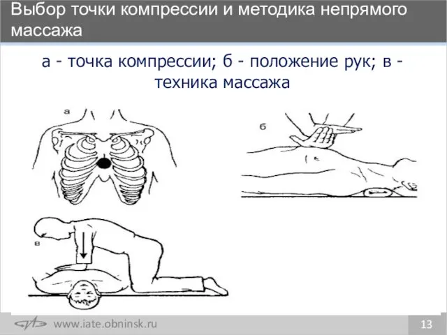 Выбор точки компрессии и методика непрямого массажа 13 а -