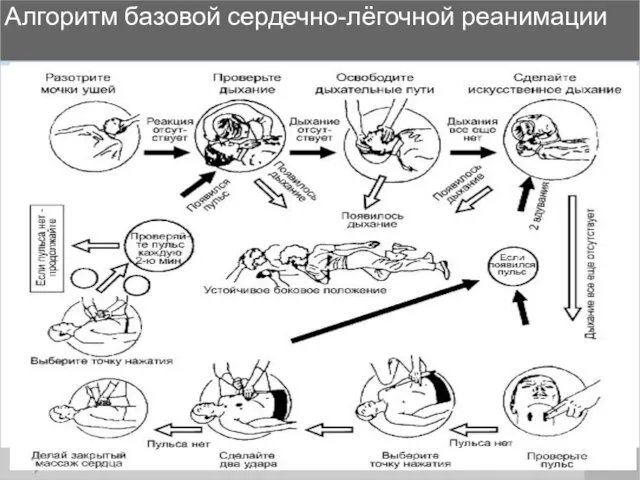 Алгоритм базовой сердечно-лёгочной реанимации 16