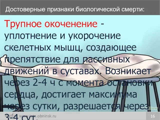 Достоверные признаки биологической смерти: 16 Трупное окоченение - уплотнение и