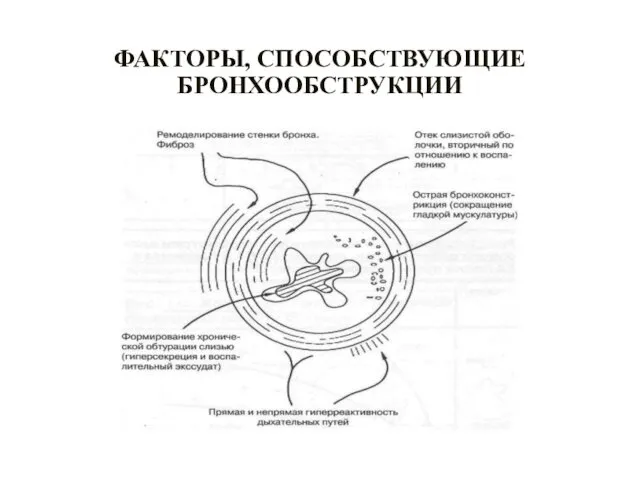 ФАКТОРЫ, СПОСОБСТВУЮЩИЕ БРОНХООБСТРУКЦИИ