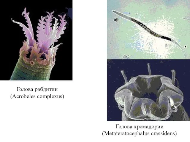 Голова хромадории (Metateratocephalus crassidens) Голова рабдитии (Acrobeles complexus)