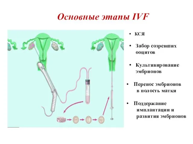 Основные этапы IVF КСЯ Забор созревших ооцитов Культивирование эмбрионов Перенос