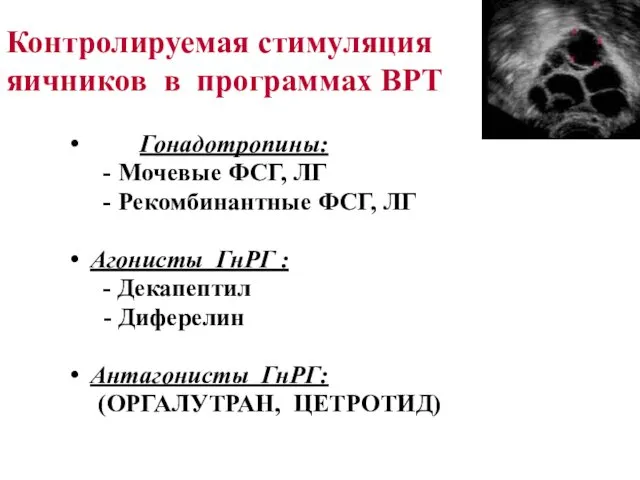 Контролируемая стимуляция яичников в программах ВРТ Гонадотропины: Мочевые ФСГ, ЛГ