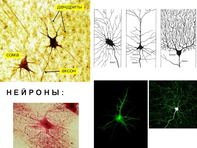 Н Е Й Р О Н Ы : аксон дендриты сома