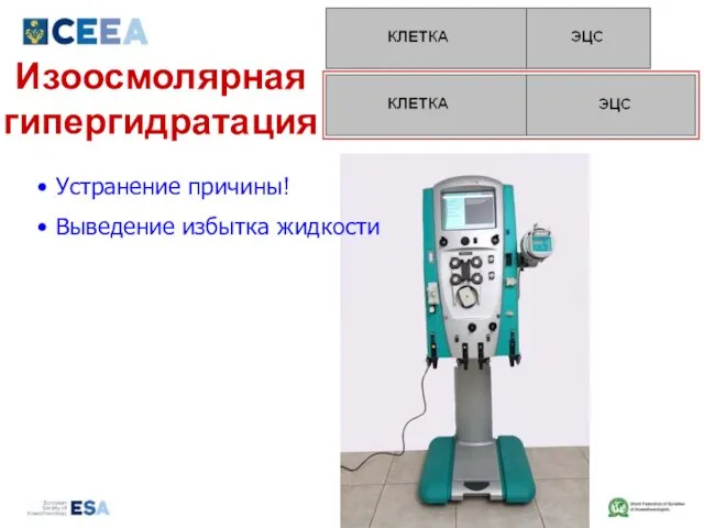 Изоосмолярная гипергидратация Устранение причины! Выведение избытка жидкости