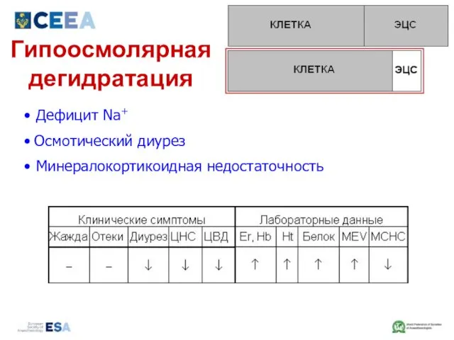 Гипоосмолярная дегидратация Дефицит Na+ Осмотический диурез Минералокортикоидная недостаточность