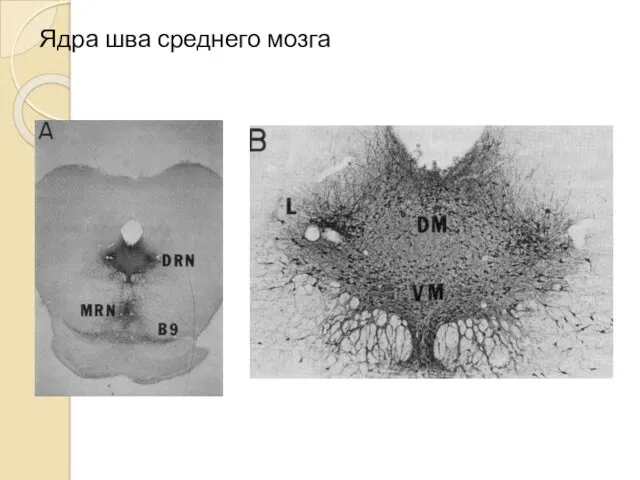 Ядра шва среднего мозга