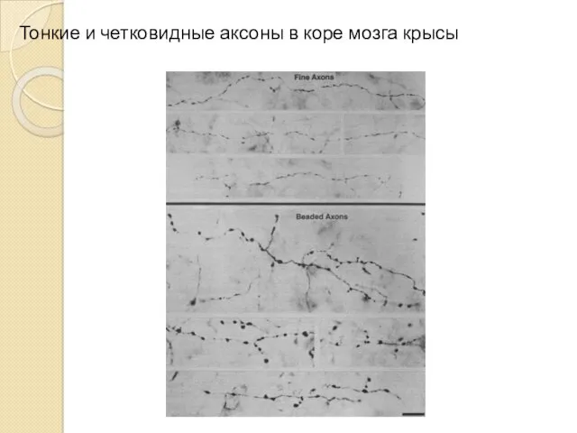 Тонкие и четковидные аксоны в коре мозга крысы