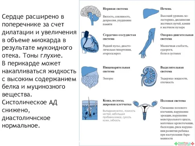 Сердце расширено в поперечнике за счет дилатации и увеличения в