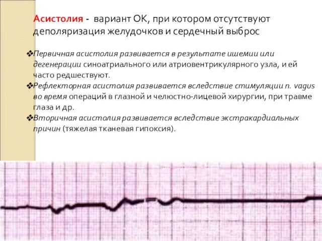 Асистолия - вариант ОК, при котором отсутствуют деполяризация желудочков и сердечный выброс Первичная