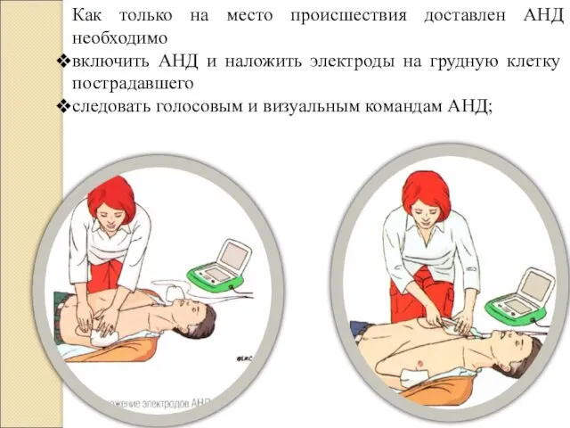 Как только на место происшествия доставлен АНД необходимо включить АНД и наложить электроды