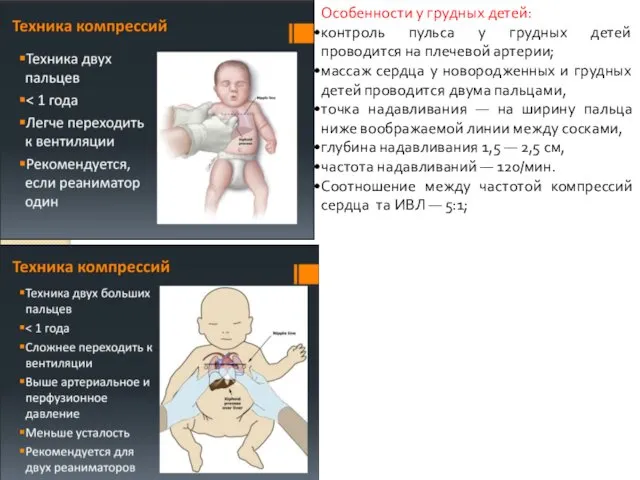 Особенности у грудных детей: контроль пульса у грудных детей проводится на плечевой артерии;