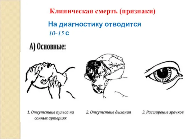 Клиническая смерть (признаки) На диагностику отводится 10-15 с