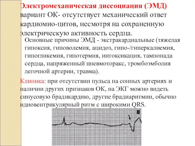 Электромеханическая диссоциация (ЭМД) вариант ОК- отсутствует механический ответ кардиомио-цитов, несмотря на сохраненную электрическую