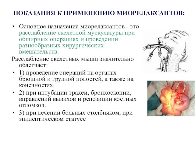 ПОКАЗАНИЯ К ПРИМЕНЕНИЮ МИОРЕЛАКСАНТОВ: Основное назначение миорелаксантов - это расслабление