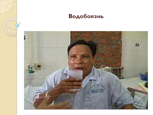 Водобоязнь