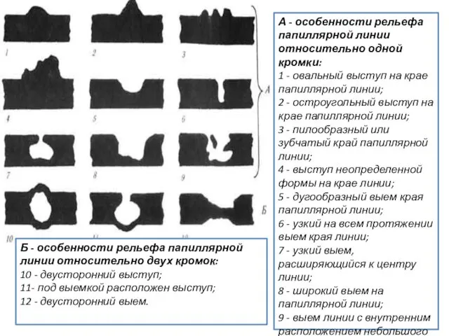 А - особенности рельефа папиллярной линии относительно одной кромки: 1