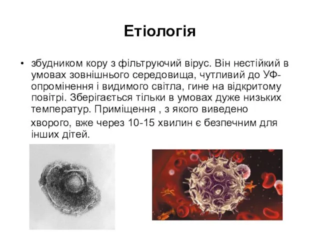 Етіологія збудником кору з фільтруючий вірус. Він нестійкий в умовах